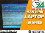 Nguyên nhân gây ra Laptop bị nhiễu màn hình và cách khắc phục